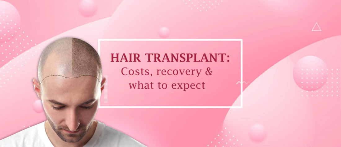 Everything You Need To Know Before You Go For Hair Transplant (Explained)